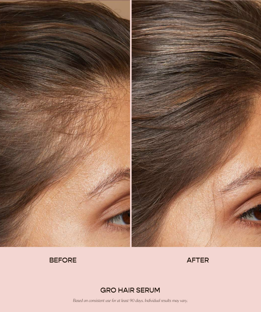 GRO Hair Serum