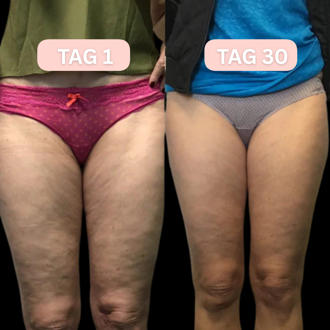 Cellufit - Massageroller